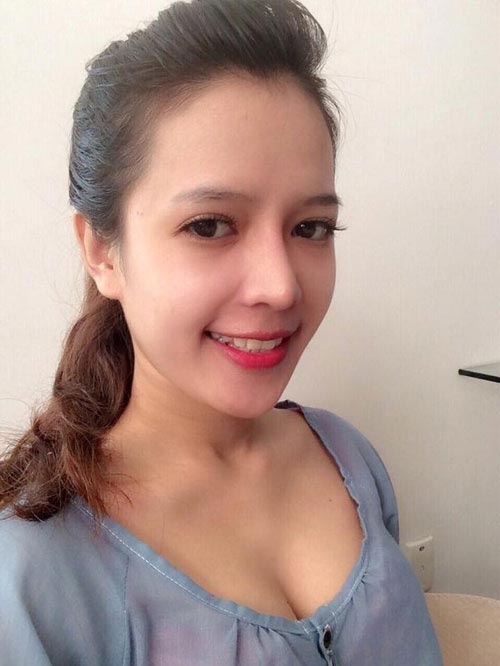 Minh Yến sau quá trình phẫu thuật thành công.
