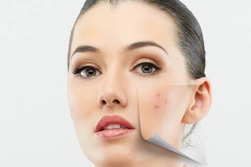 Doi pho voi o nhiem, khoi bui de lam dep da hinh anh