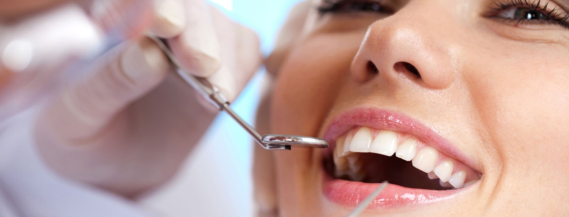 Có rất nhiều phương pháp chỉnh sửa răng thưa.