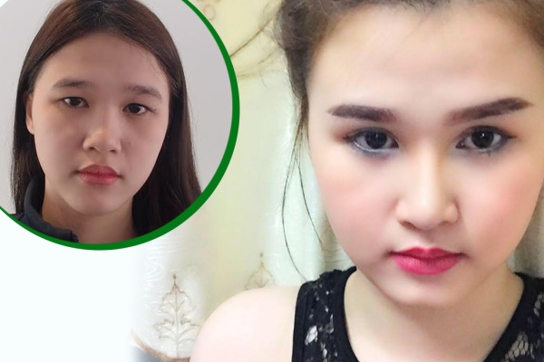 4 ca phau thuat doi doi cua ban tre Viet hinh anh