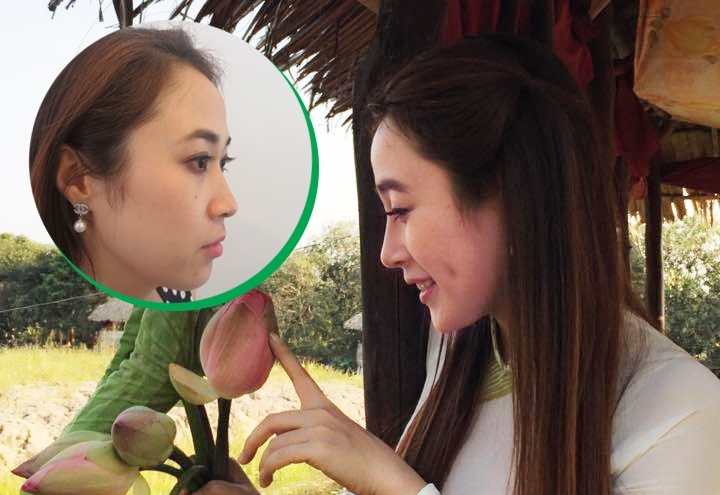 Vi sao nang mui S-line ma van chua dep? hinh anh