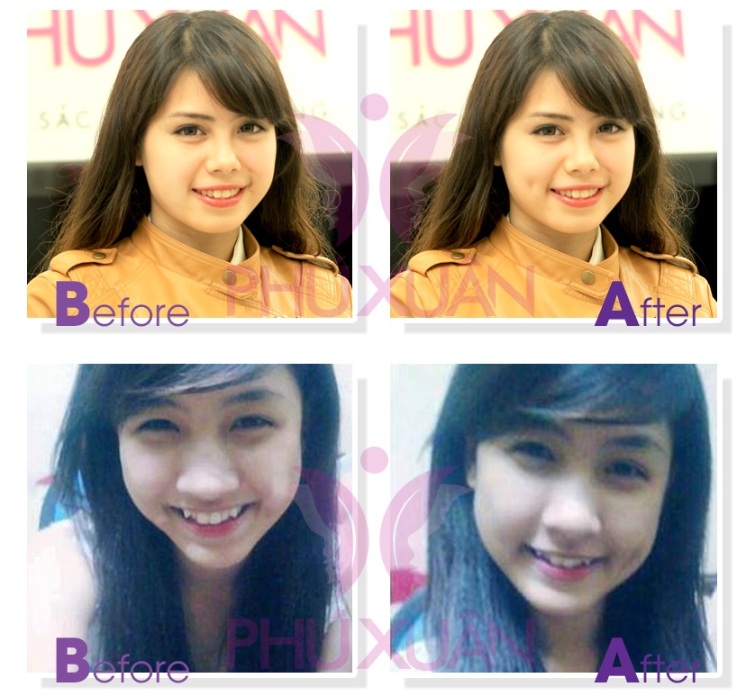 Khách hàng tạo má lúm đồng tiền.