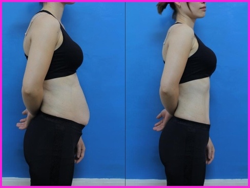 Khách hàng giảm béo