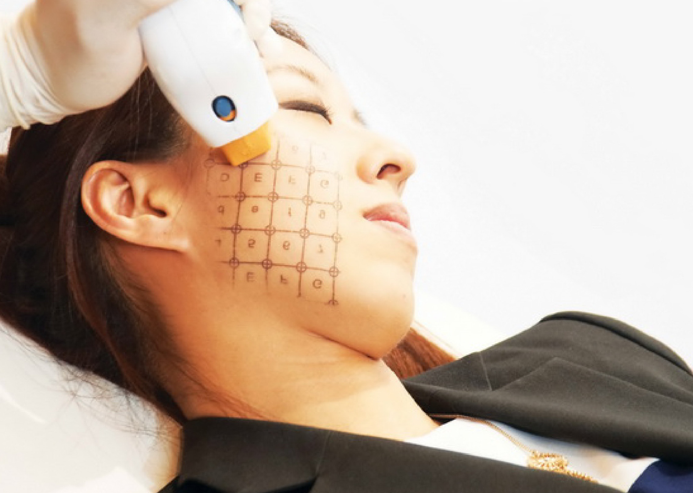 Cach dieu tri Thermage theo tung guong mat hinh anh