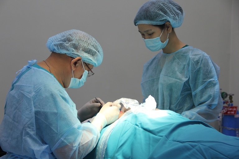 Khac phuc nep nhan quanh mat bang phau thuat cang co hinh anh