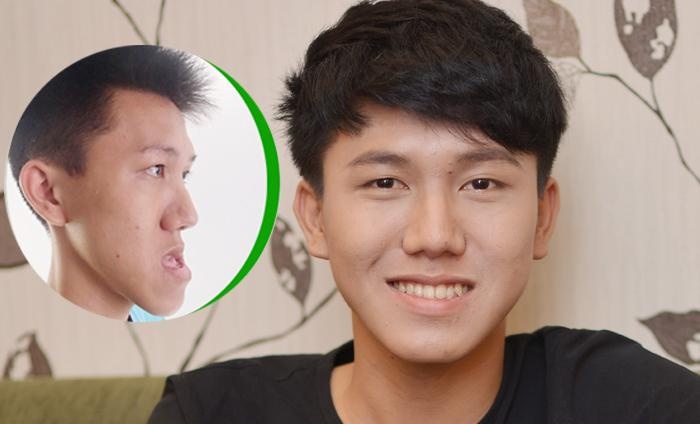 Sau nhiều năm mặc cảm về vẻ ngoài, nay Trần Lữ Anh Khoa đã tự tin khoe nụ cười rạng rỡ.
