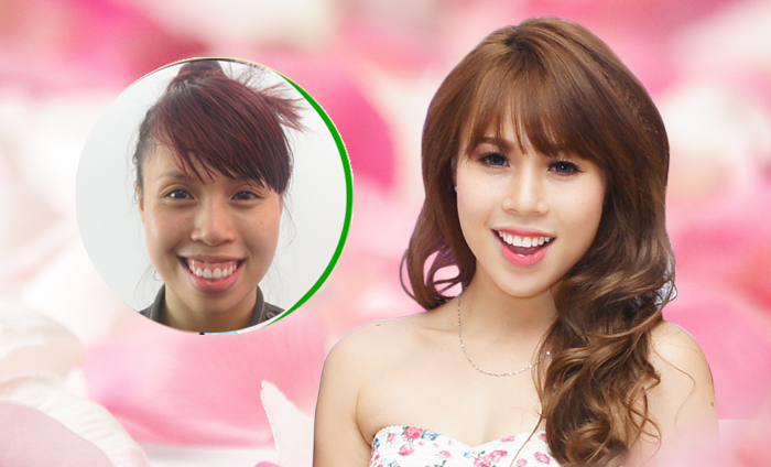 3 yeu to de phau thuat toan dien khuon mat thanh cong hinh anh