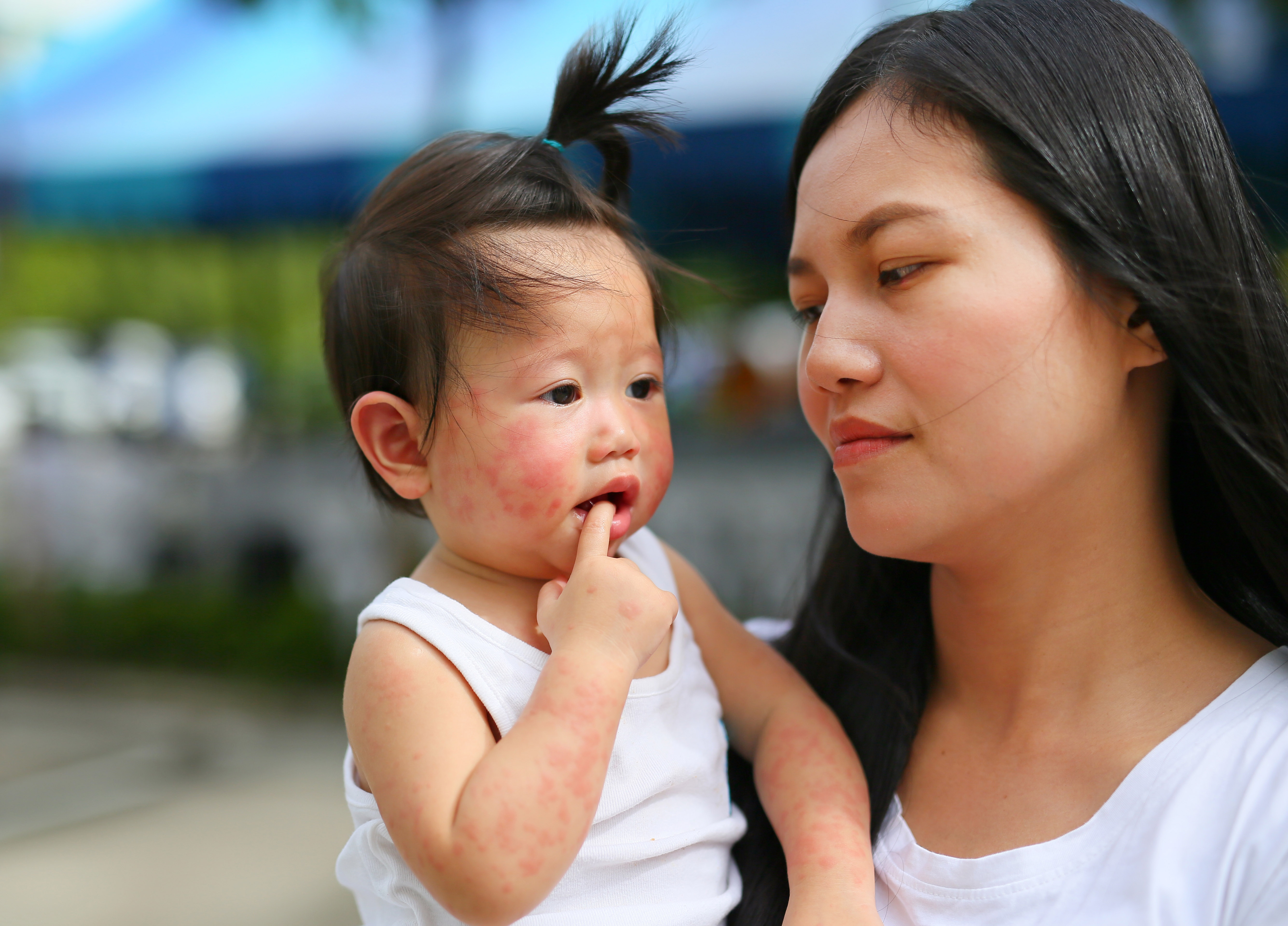 Nhung quan niem sai lam ve tay chan mieng hinh anh