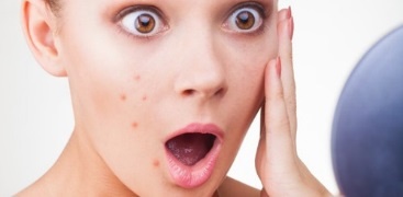 Bạn gái đừng thức xem phim thâu đêm hay lo nghĩ nhiều nếu không muốn mụn xuất hiện.
