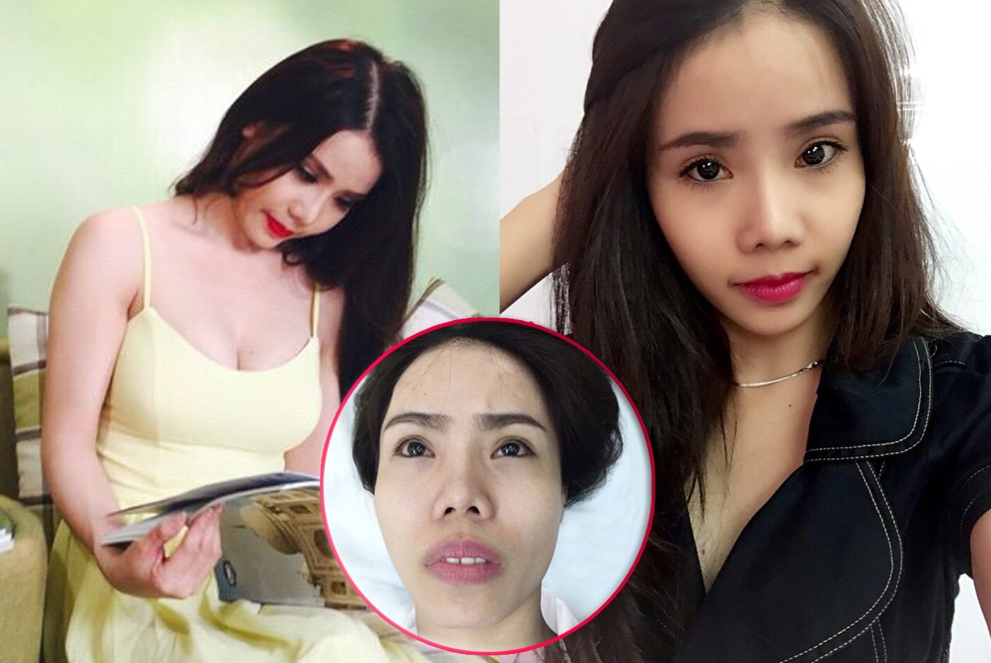 Benh vien tham my Ngoc Phu - dia chi lam dep uy tin hinh anh