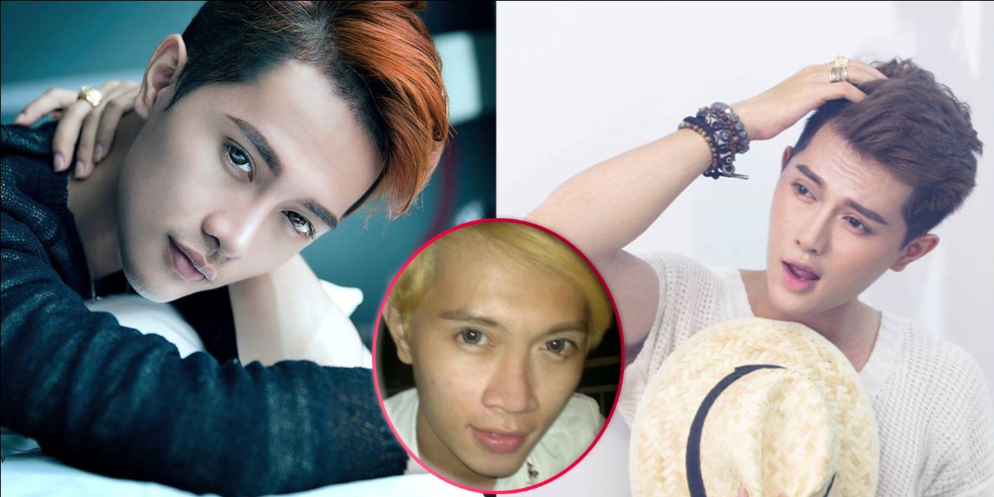 Nhật Thanh đẹp hơn sau khi phẫu thuật thẩm mỹ.