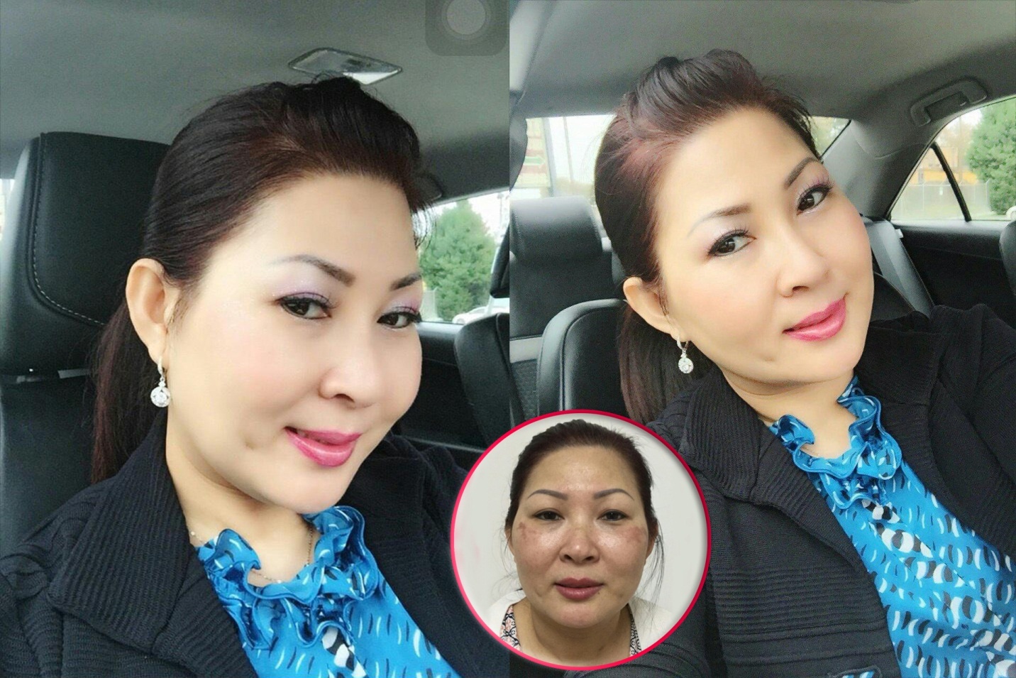 Doanh nhân Thanh Thúy đang sống tại Mỹ cảm thấy tự tin hơn khi gặp khách hàng và công việc kinh doanh ngày càng phát triển sau khi thẩm mỹ.