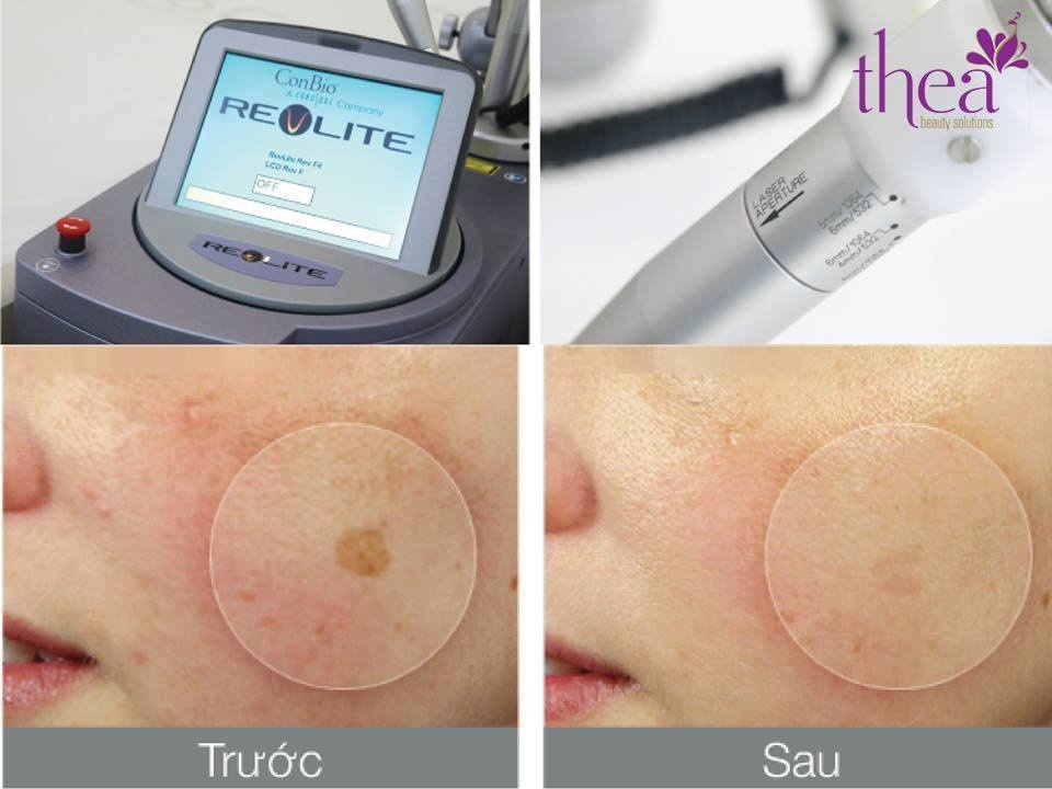 Công nghệ có khả năng trẻ hóa mạnh và được xem như một liều thuốc nuôi dưỡng và tái tạo da, làm giảm quá trình sừng hóa, sạm nám, mang lại độ sáng mịn và cung cấp độ ẩm trên bề mặt da.