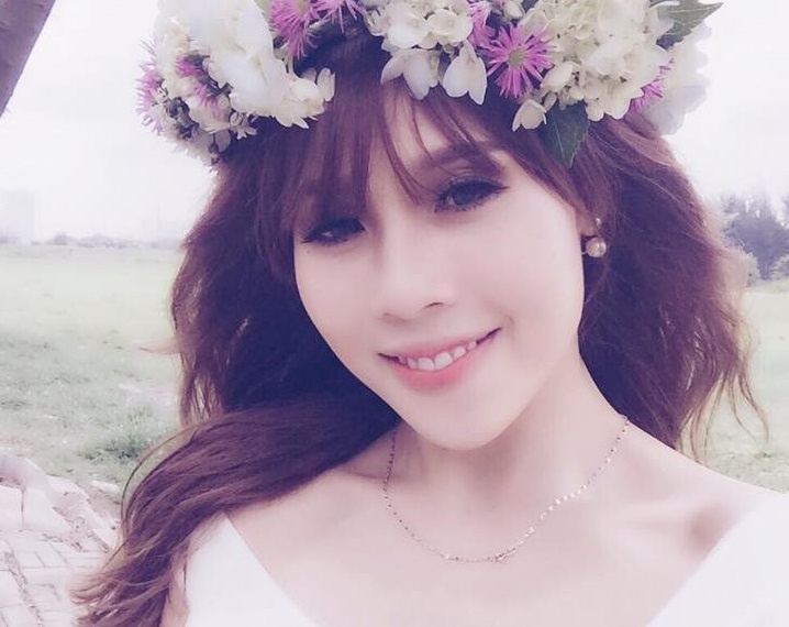 Nu bien dao mua phau thuat tham my de thanh cong hinh anh