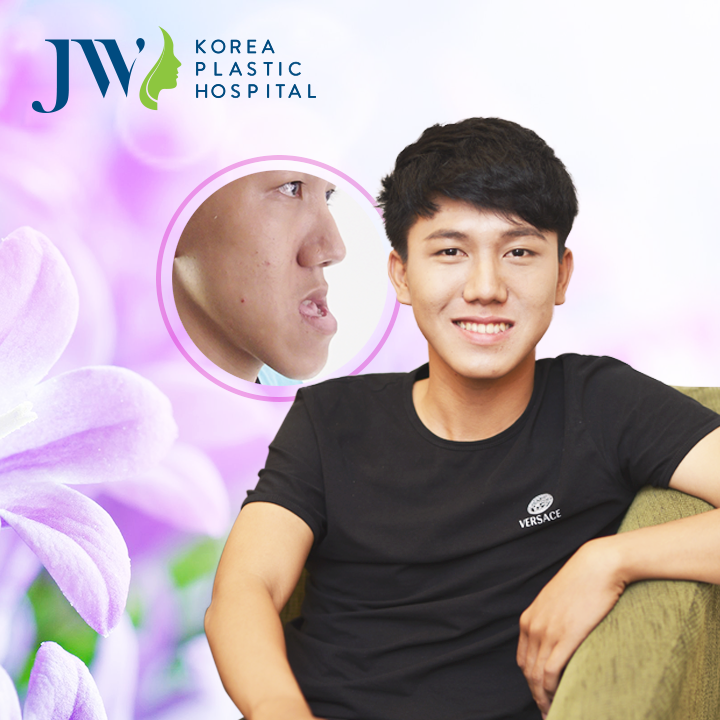 phau thuat ham ho mom khong can nieng rang anh 3