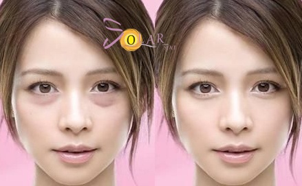 Xoa nhan, danh tan bong mo mat trong 60 phut hinh anh