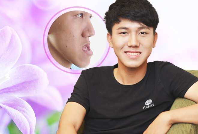 Nguyen nhan chinh dan den ho mom hinh anh