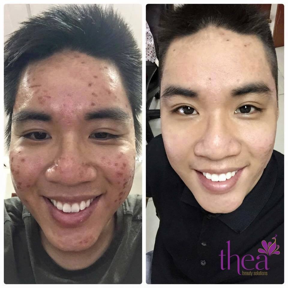 Thea Beauty Solutions anh 2