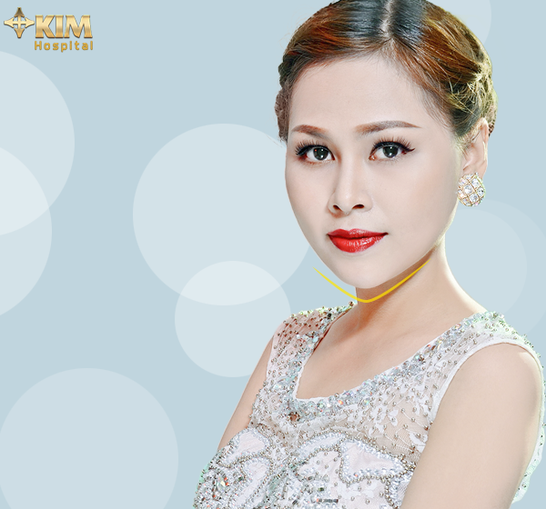 KIM hospital khuyến mãi 15 triệu đồng ảnh 3 KIM hospital khuyen mai 15 trieu dong anh 3