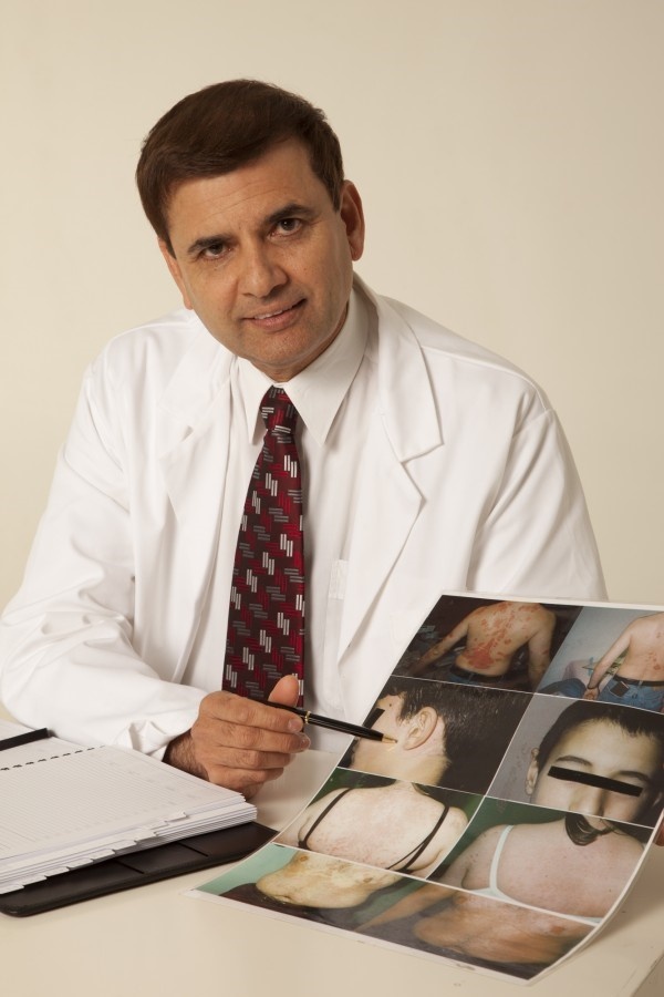 benh vay nen co tinh di truyen anh 1