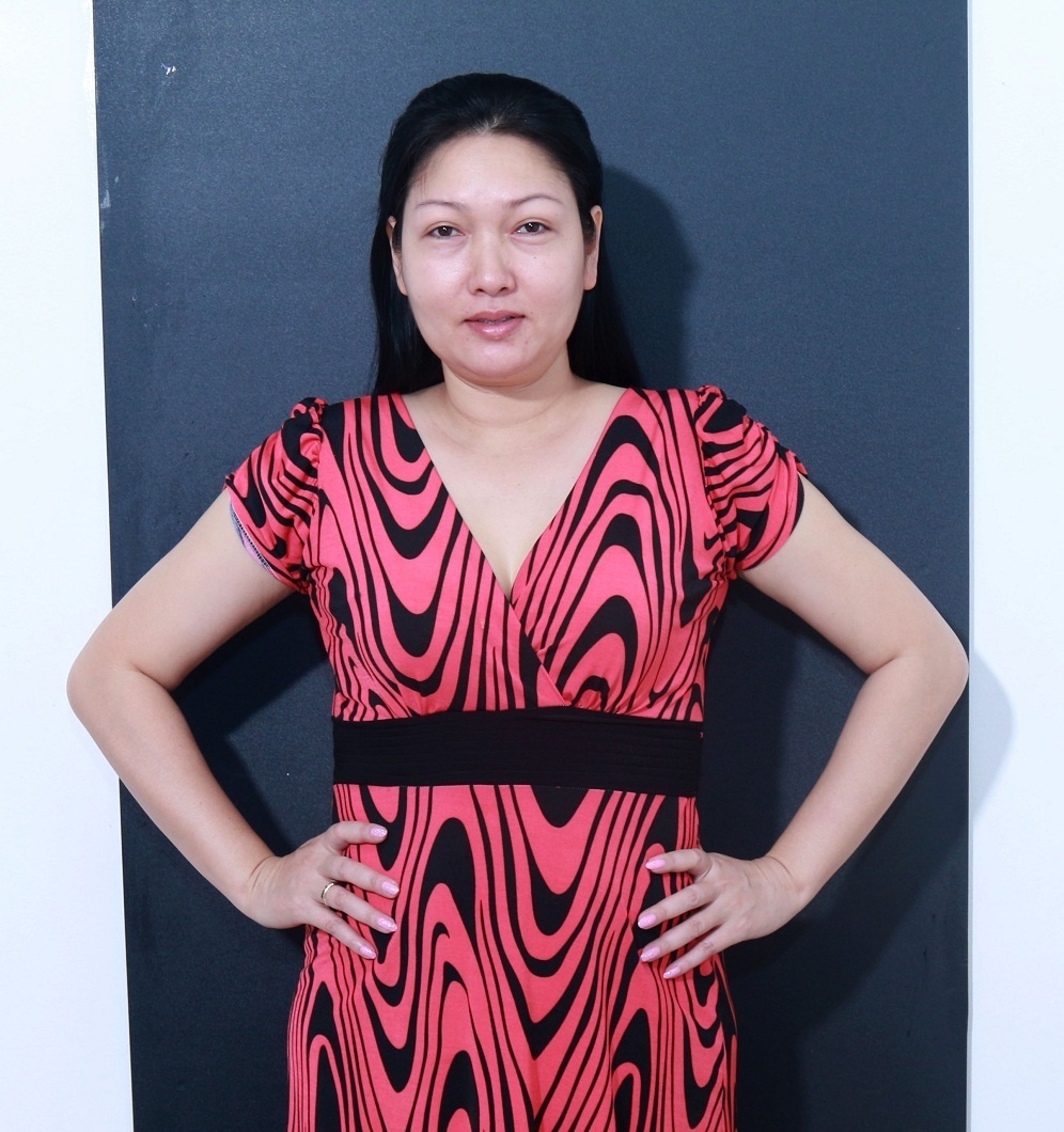 chi gai Nhat Kim Anh phau thuat tham my anh 1