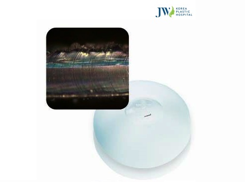 nang nguc Nanochip tai benh vien JW anh 1