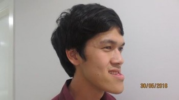 phau thuat tham my tai benh vien JW anh 1