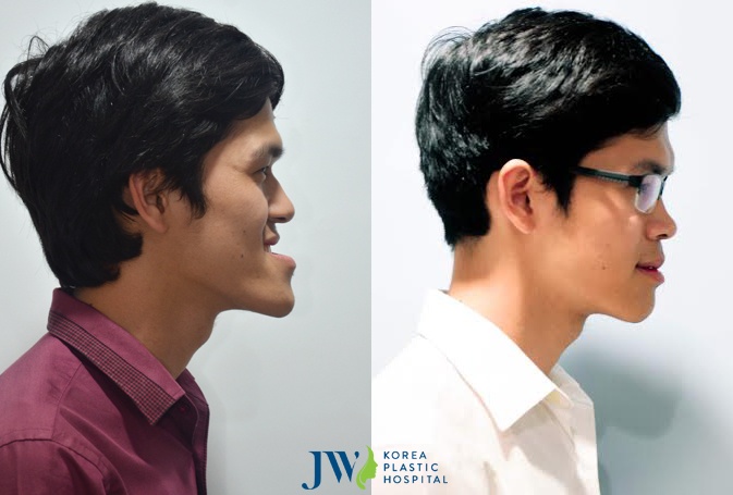 phau thuat tham my tai benh vien JW anh 3