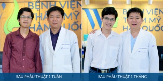 phẫu thuật hô móm tại JW ảnh 2 phau thuat ho mom tai JW anh 2