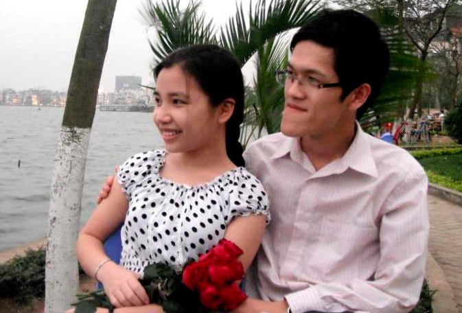 Khac biet truoc va sau phau thuat cua chang trai mom 14 nam hinh anh