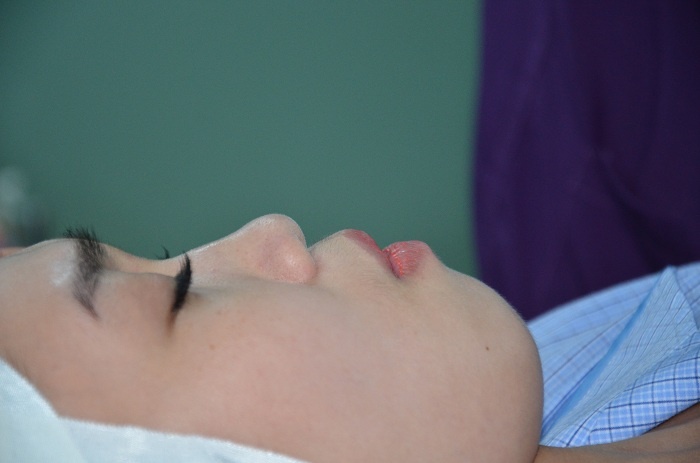 nang mui S-line tai JW anh 2