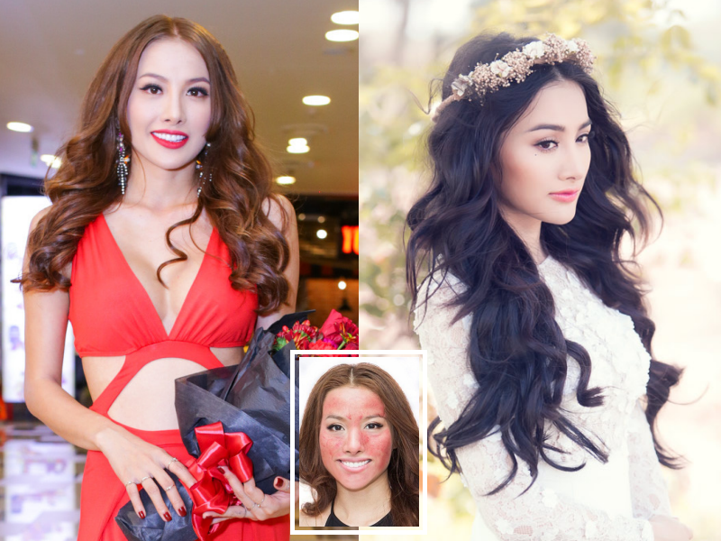 Thea Beauty Solutions giảm giá dịp hè ảnh 3 Thea Beauty Solutions giam gia dip he anh 3