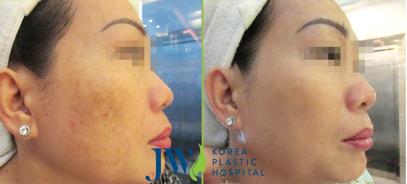 Trung tâm Skincare Bệnh viện thẩm mỹ JW Hàn Quốc ảnh 3 Trung tam Skincare Benh vien tham my JW Han Quoc anh 3