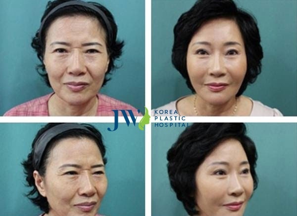 chuong trinh Tim lai tuoi xuan cho me cua JW anh 1