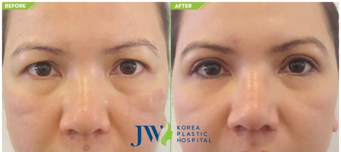 chuong trinh Tim lai tuoi xuan cho me cua JW anh 3