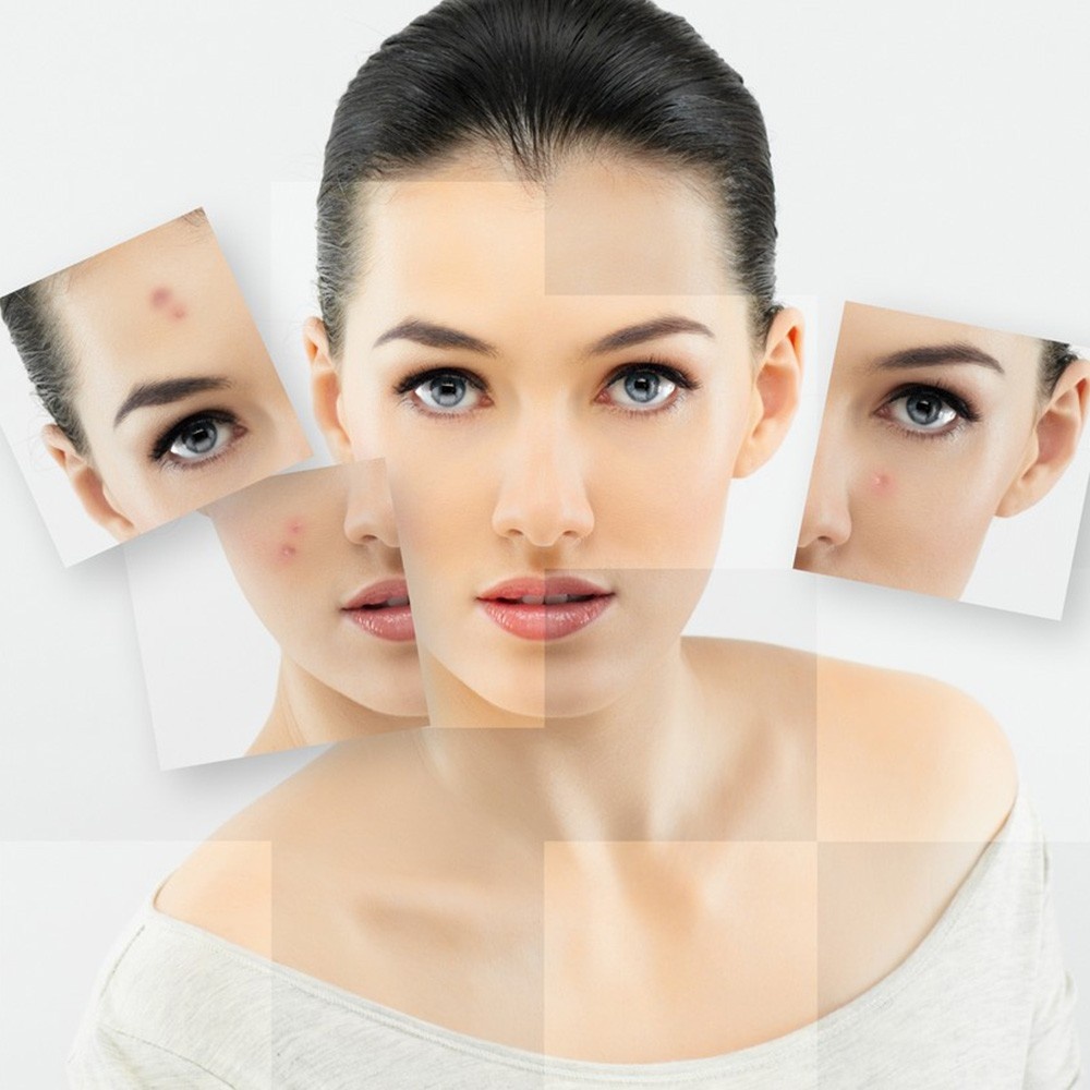 Ngay hoi tri nam,  tre hoa da toan dien tai JW anh 1