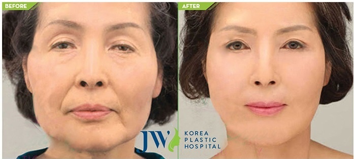 Ngay hoi tri nam,  tre hoa da toan dien tai JW anh 2