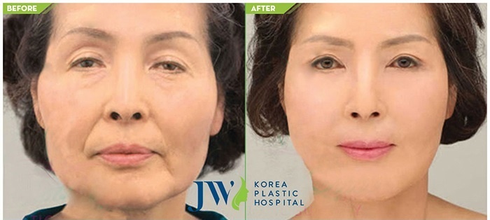 Ngay hoi tri nam,  tre hoa da toan dien tai JW anh 4