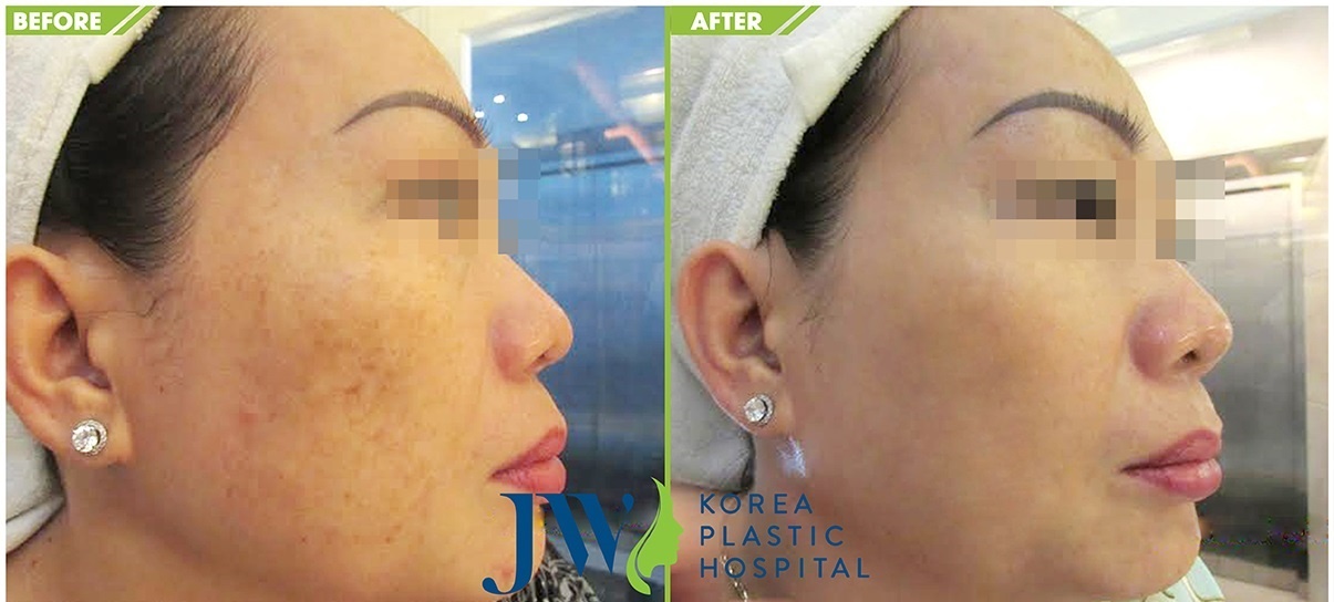 Ngay hoi tri nam,  tre hoa da toan dien tai JW anh 5