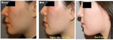 Ngay hoi tri nam,  tre hoa da toan dien tai JW anh 4