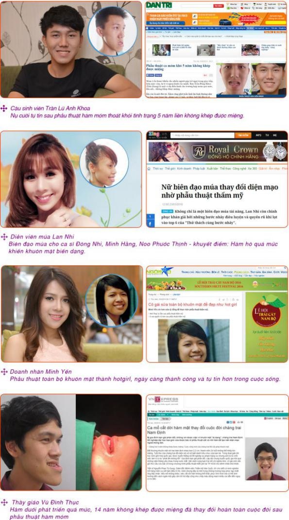 Bệnh viện thẩm mỹ JW Hàn Quốc ảnh 7 Benh vien tham my JW Han Quoc anh 7