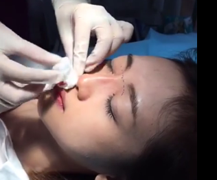 Tham my khong phau thuat duoc nhieu khach hang quan tam hinh anh