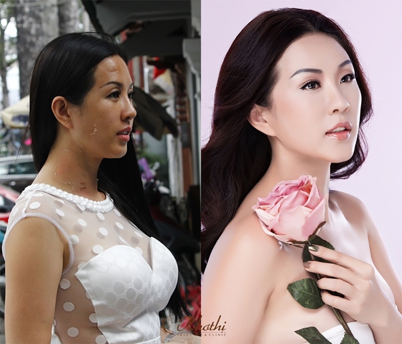 bi quyet giu lan da tre trung cua hoa hau Thu Hoai anh 7