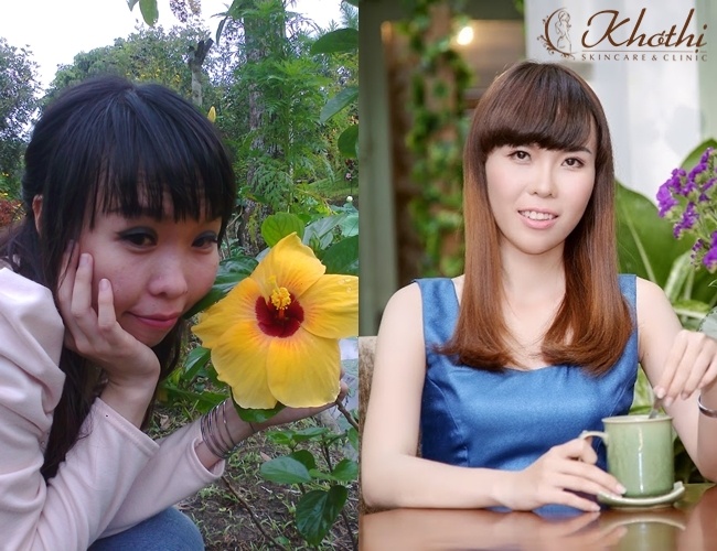 Vien tham my Kho Thi anh 2