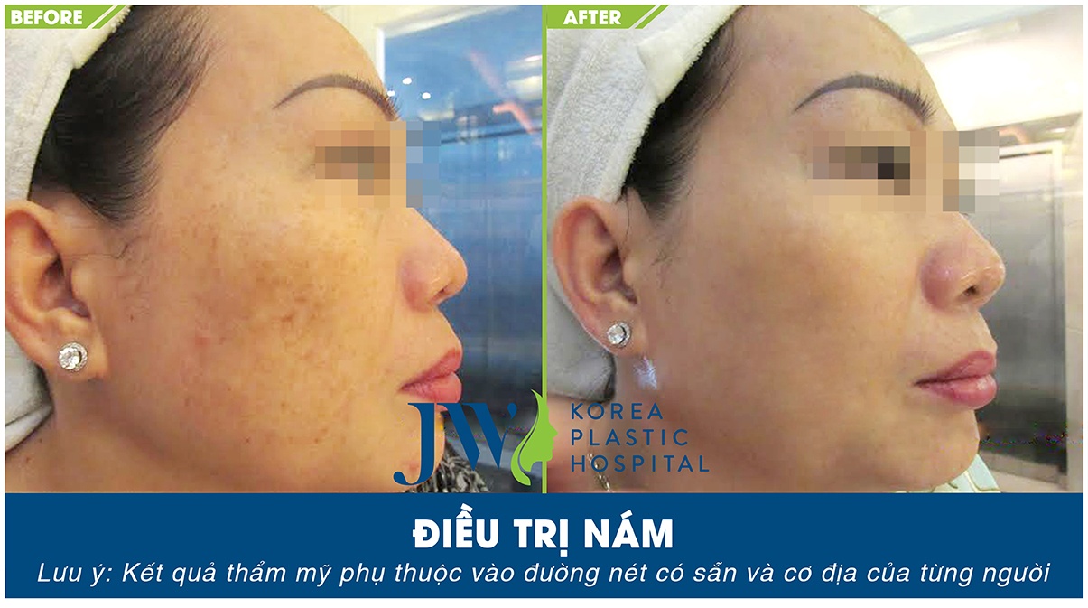 Skincare JW anh 1