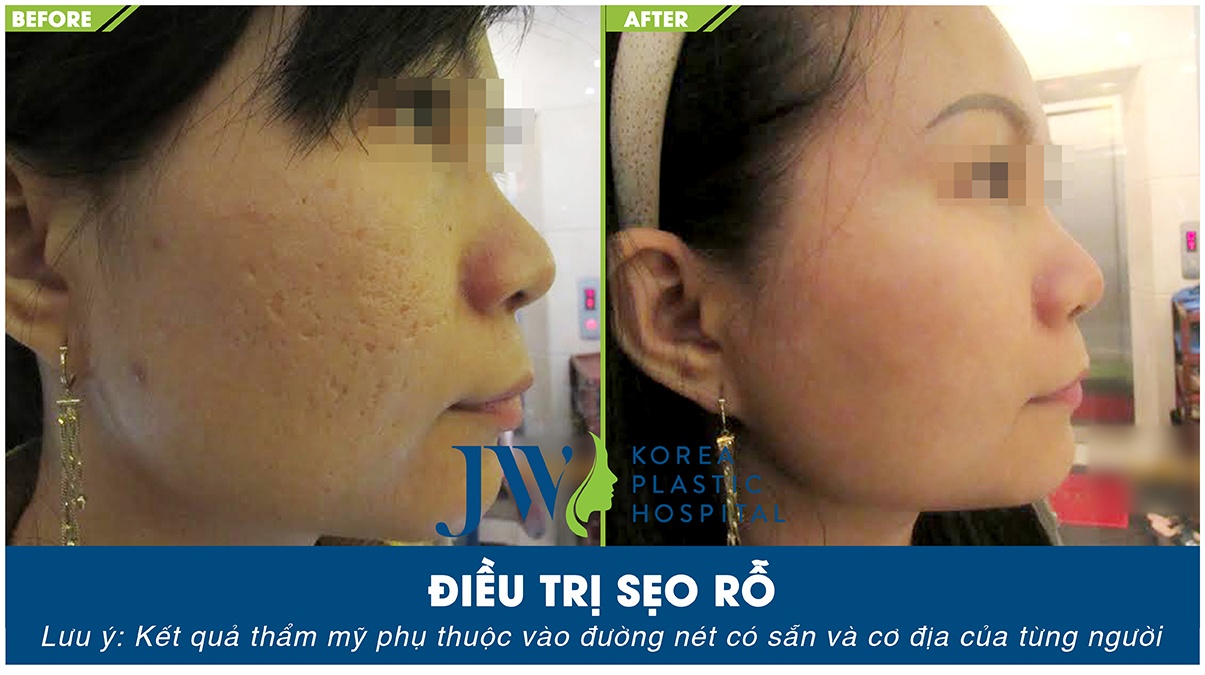 Skincare JW anh 2