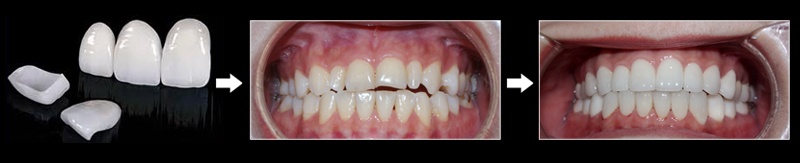 Benh vien tham my JW Han Quoc anh 2