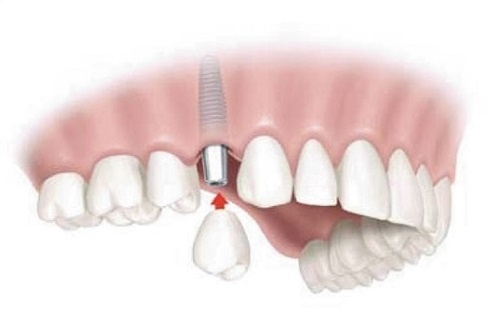 Benh vien tham my JW Han Quoc anh 4