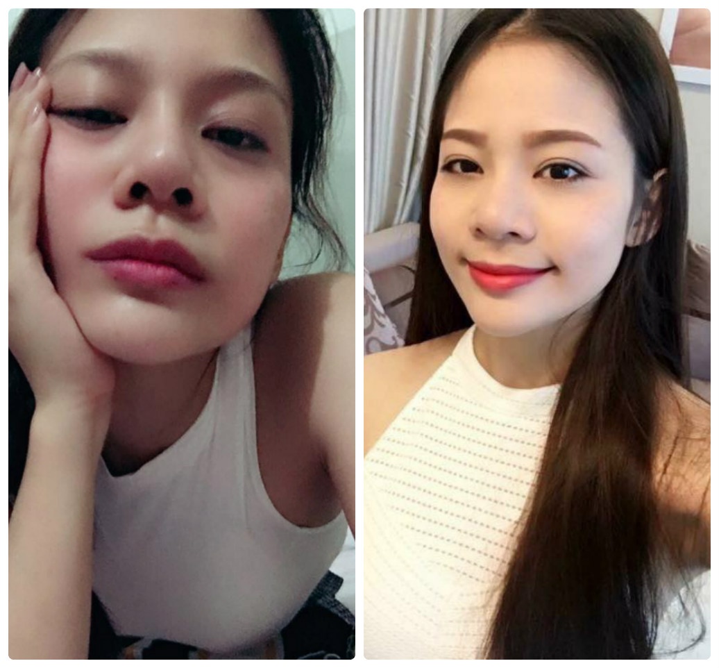 bệnh viện thẩm mỹ Kangnam ảnh 5 benh vien tham my Kangnam anh 5