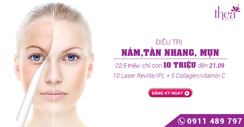 làm đẹp tại Thea ảnh 5 lam dep tai Thea anh 5